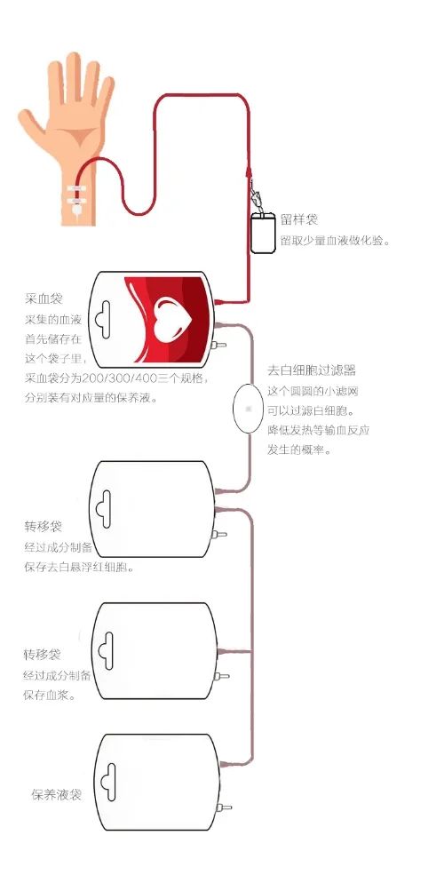 獻血時採血袋一般分為三聯袋或者四聯袋:200ml,300ml是三聯袋,400ml是